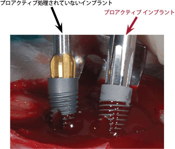 ネオスインプラントの表面性状