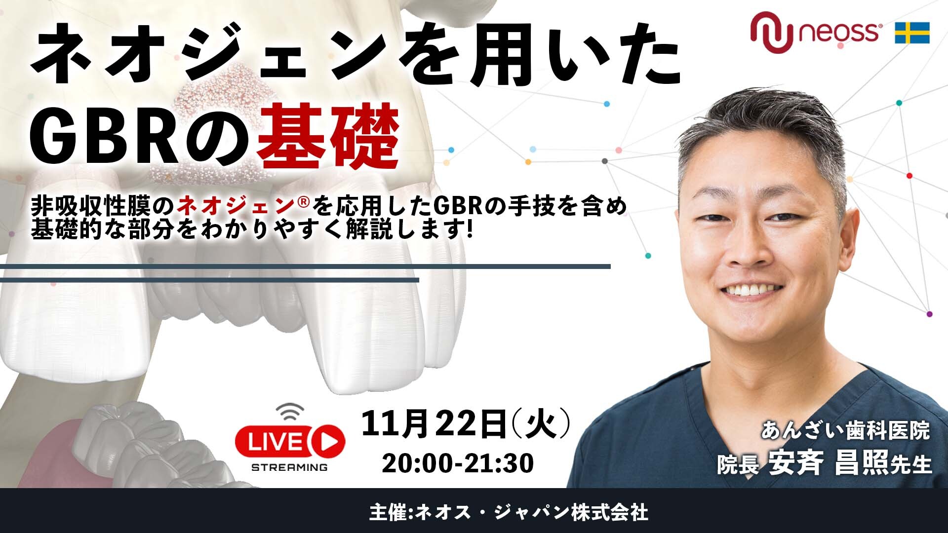 【終了しました】【2022年 11月22日】<br>ネオジェンを用いたGBRの基礎<br>