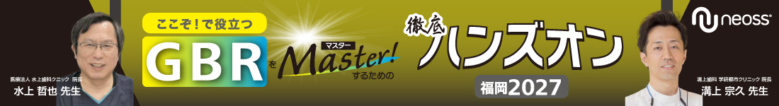 GBR 基本をマスターするための徹底ハンズオン 福岡